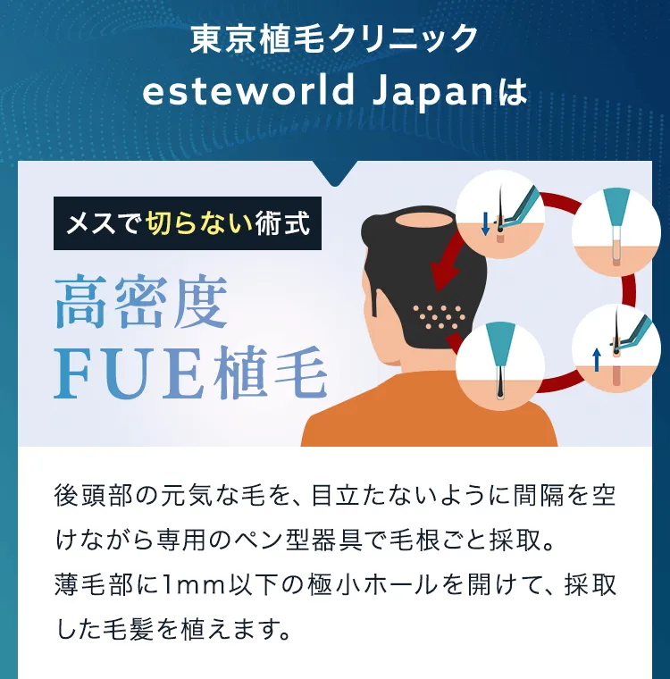 東京植毛クリニックesteworld Japanは