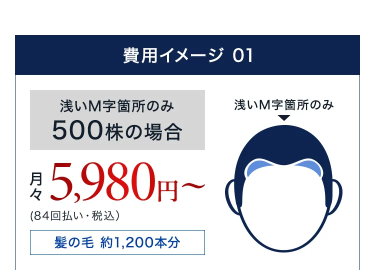 浅いM字箇所のみ500株の場合