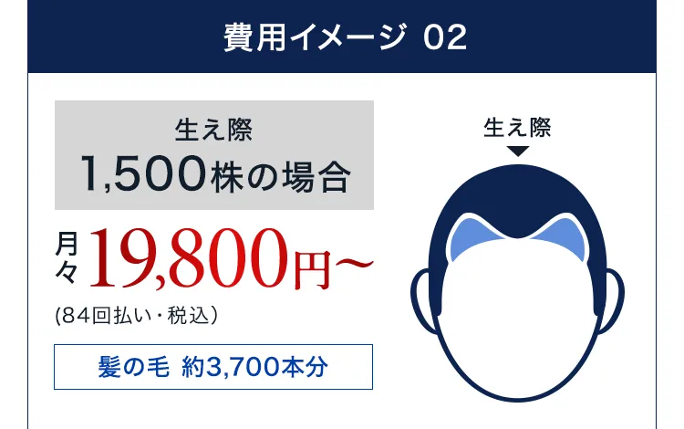 生え際1,500株の場合