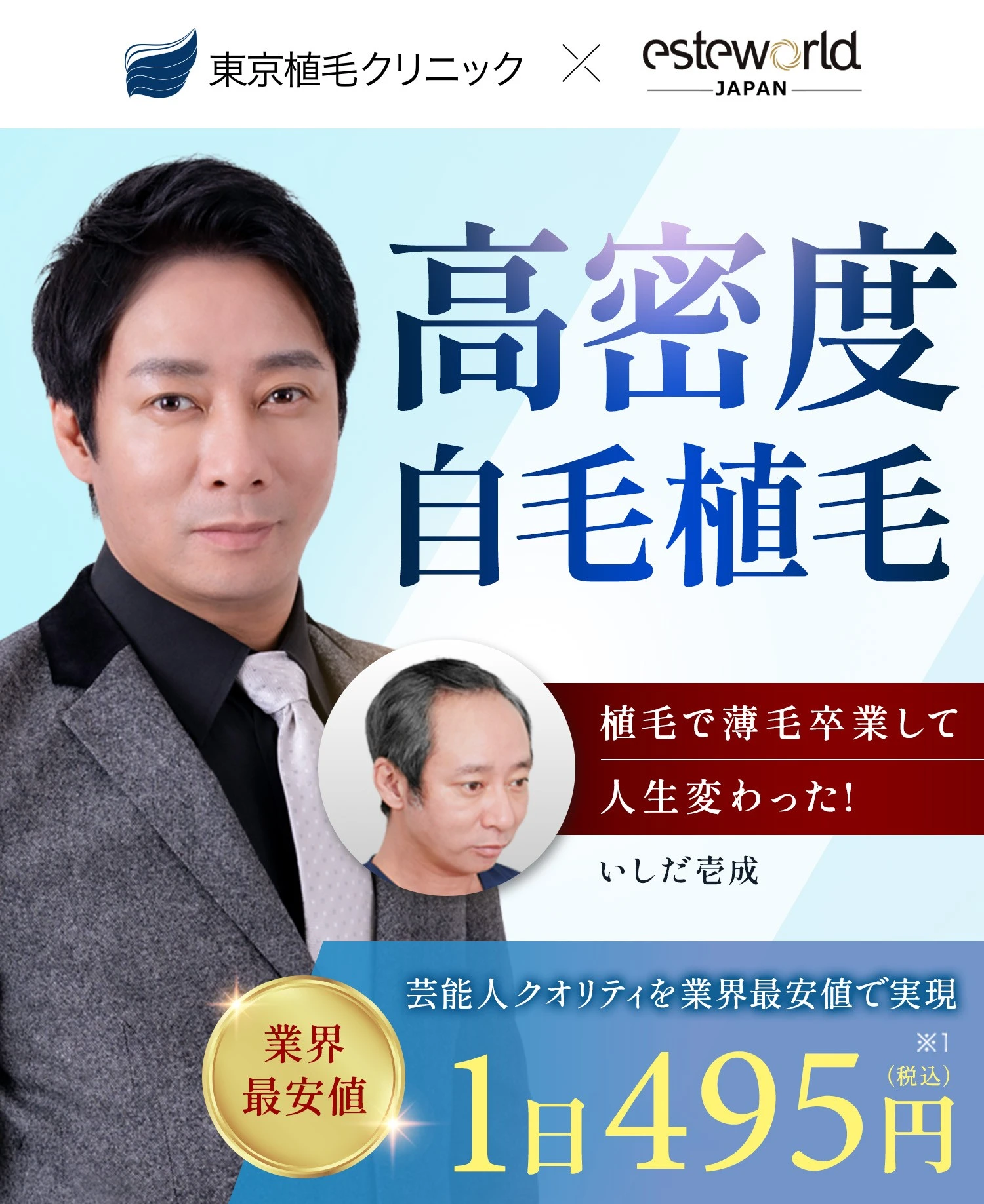 人気のトルコ式植毛を日本で