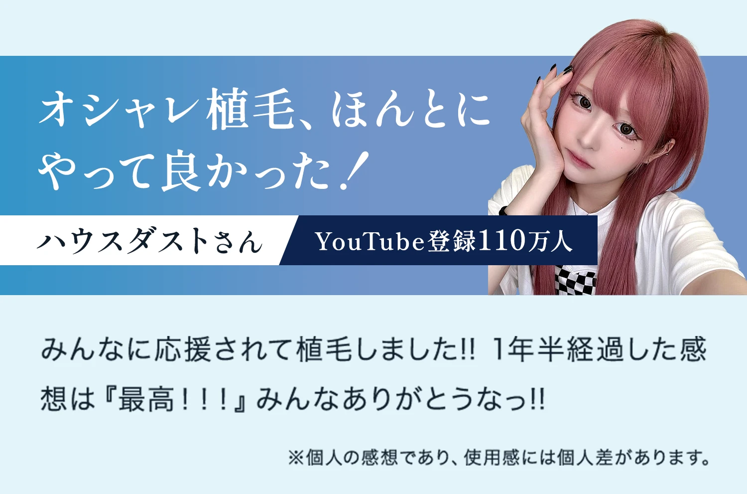 オシャレ植毛、ほんとにやって良かった！