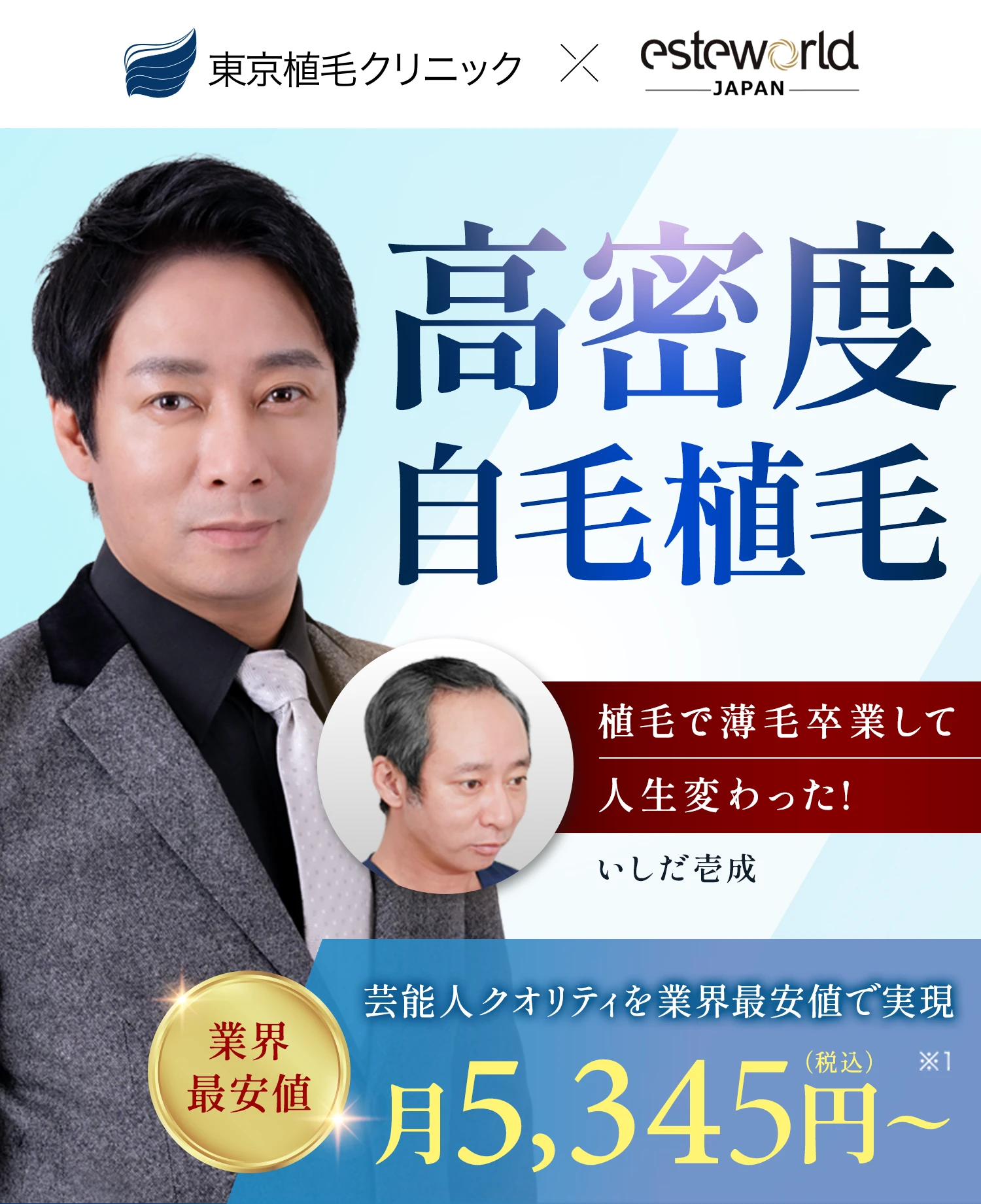 人気のトルコ式植毛を日本で