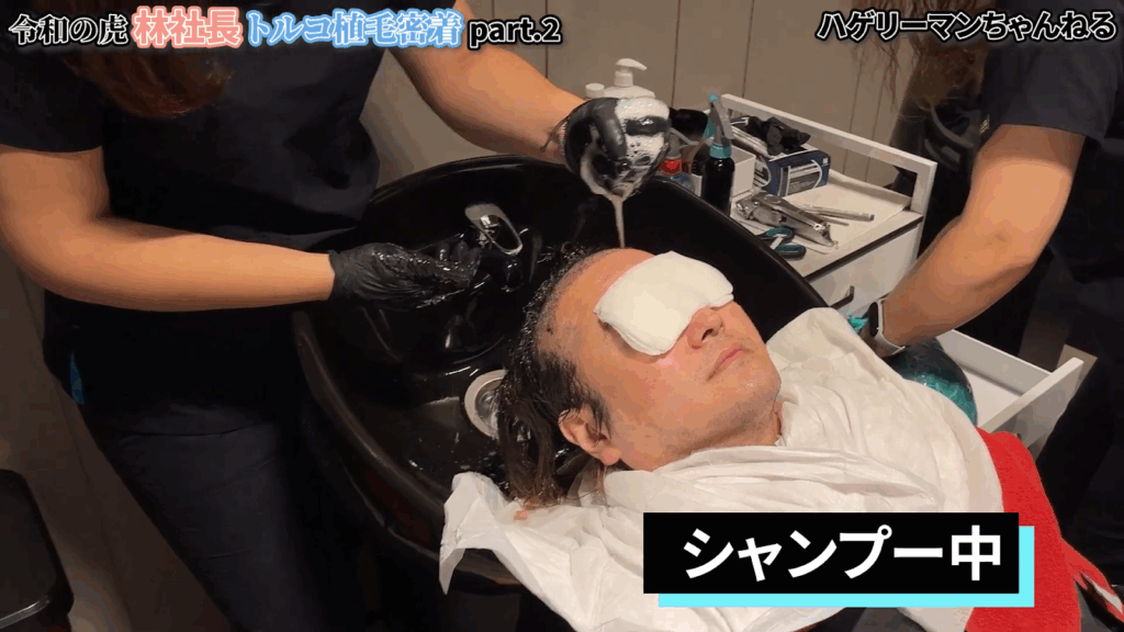 手術後のシャンプー|自分でやるのは大変?