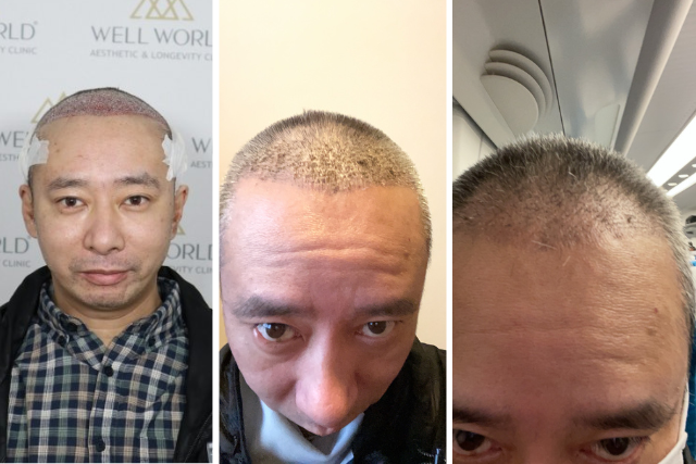 いしだ壱成さん3ヶ月後まで
